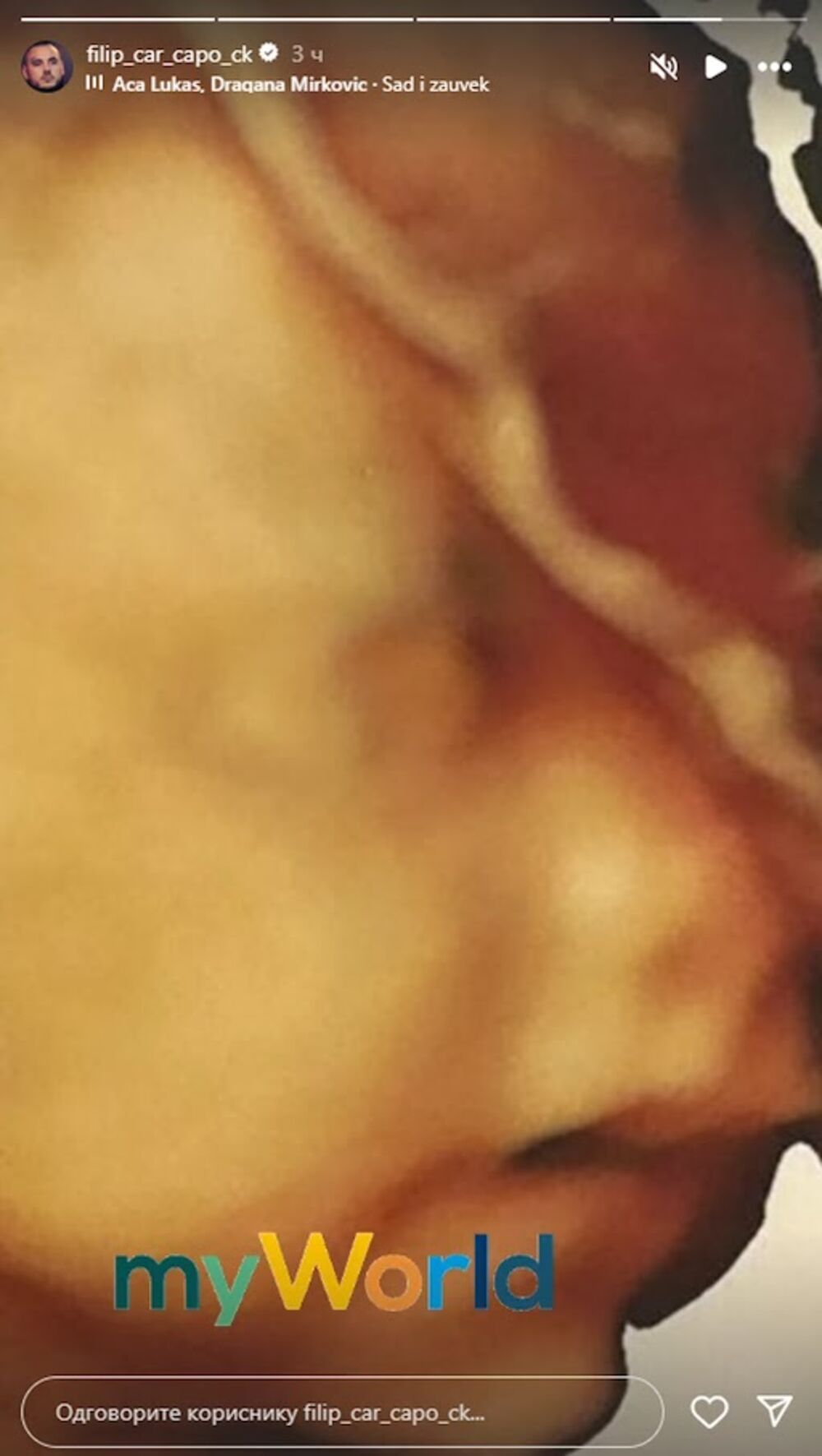 Car je podelio fotografiju ultrazvuka svoje ćerke koja uskoro dolazi na svet