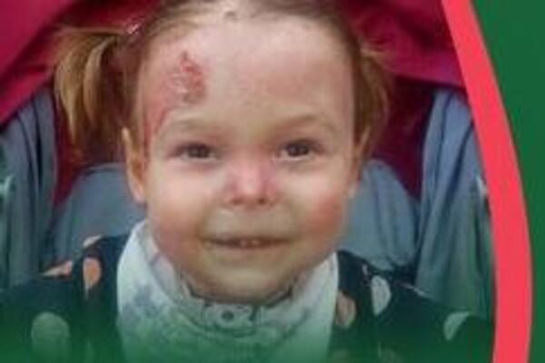 ZBOG MALENE NAĐE (4) JE PLAKALA CELA SRBIJA, A SADA STIŽU LEPE VESTI: RFZO će nabaviti jedini lek za "decu leptire"