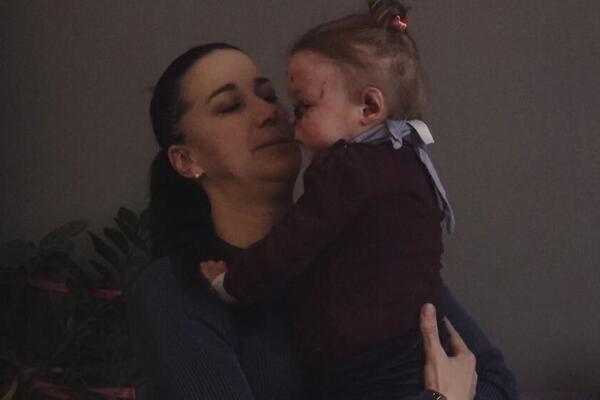 NAĐI ĆE GENSKA KREMA ZATVORITI RANE I OTVORITI MOGUĆNOST ZA BOLJI ŽIVOT: Njena hraniteljka ne krije sreću