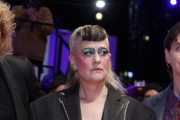 BIKINI ZONU NIJE IZDEPILIRALA PA JE PONOSNO POKAZALA: Neki će biti ZGRANUTI, DLAKE na ženama su PONOVO U FAZONU