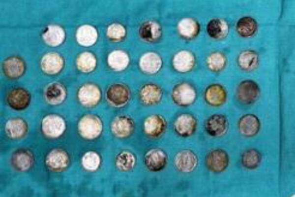 MLADIĆ PROGUTAO 39 NOVČIĆA i 37 MAGNETA, KAD SU GA SNIMILI VIDELI JEZIVU SCENU: Lekari nisu mogli DOĆI SEBI od ŠOKA