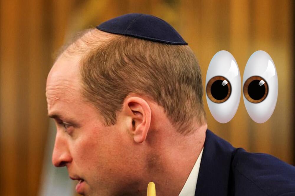 DETALJ NA LICU I VRATU PRINCA VILIJAMA ZAPREPASTIO SVET: Pitaju se šta mu se DEŠAVA, NIJE MOGAO DA SAKRIJE (FOTO)