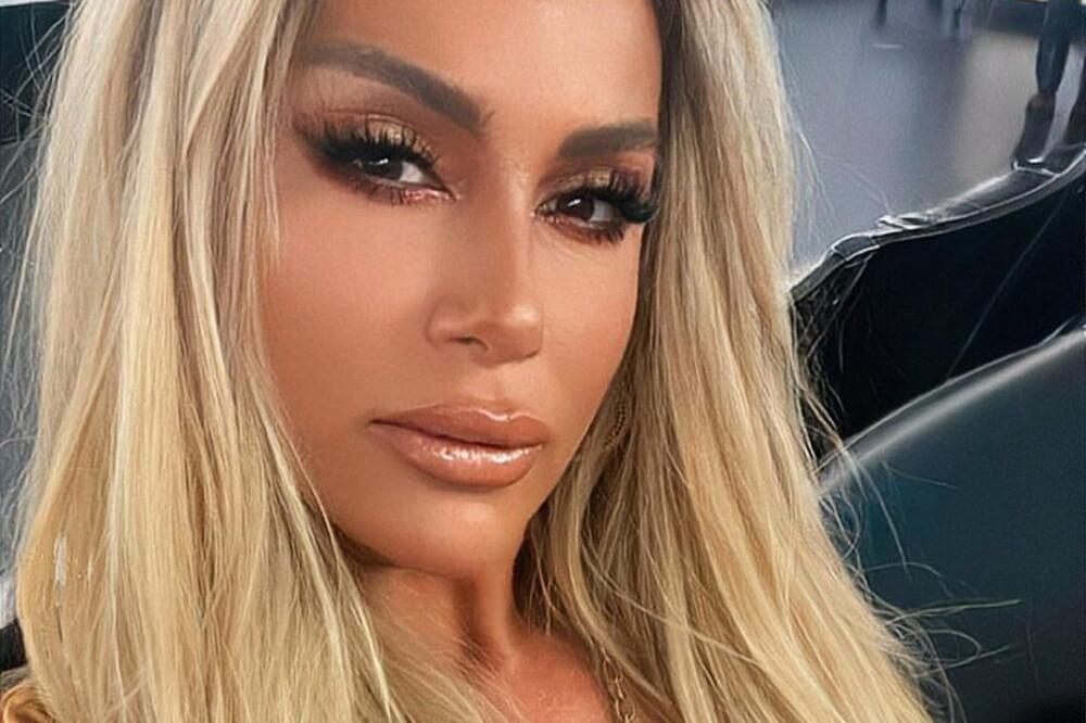 OBJAVILA FOTKU DA JOJ JE LICE U MODRICAMA I PODLIVIMA, PA SE OGLASILA POSLE 6 SATI: Evo šta se desilo Selmi Bajrami