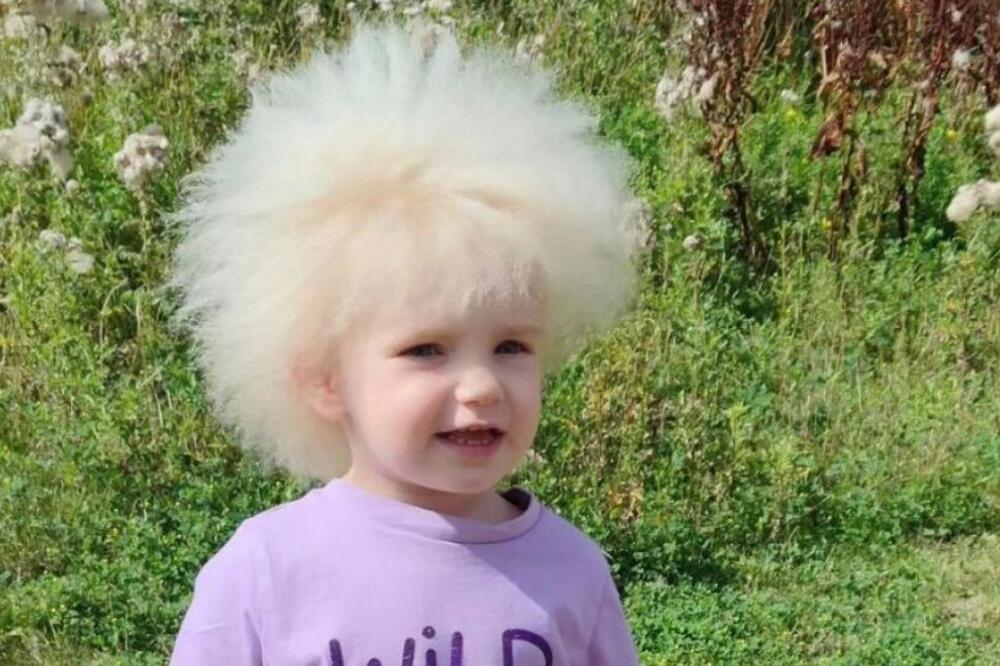 OVA DEVOJČICA NOSI IME LEJLA, A ZOVU JE BORIS ZBOG JEDNE STVARI: Poseduje REDAK POREMEĆAJ, kad je vide ZABEZEKNU SE