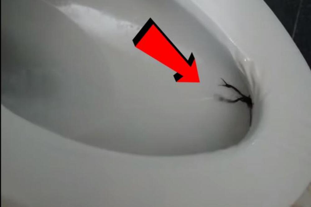 SELA JE NA WC ŠOLJU I OSETILA DA SE NEŠTO ISPOD MIGOLJI: Kad je ustala, oblio ju je hladan znoj, MOGLA JE DA UMRE