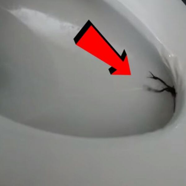 SELA JE NA WC ŠOLJU I OSETILA DA SE NEŠTO ISPOD MIGOLJI: Kad je ustala, oblio ju je hladan znoj, MOGLA JE DA UMRE