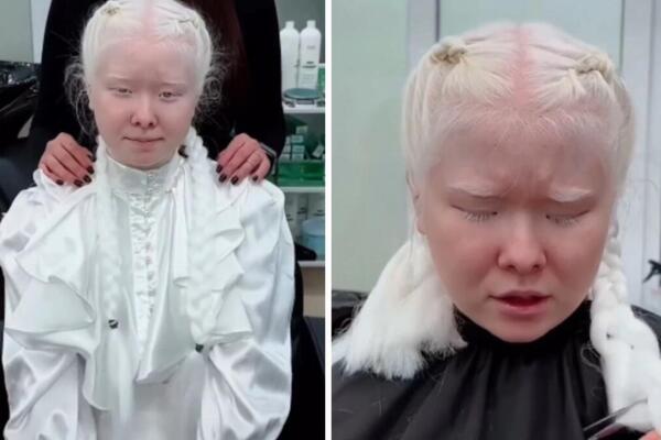 O OVOJ TRANSFORMACIJI ALBINO DEVOJKE BRUJI INTERNET: Od PROZIRNO BELE OSOBE postala je PRELEPA BRINETA (VIDEO)