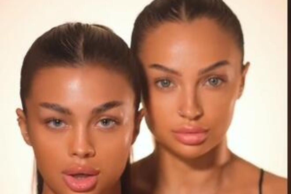 NJIH DVE TOLIKO LIČE DA NIKOME NIJE JASNO KO JE MAJKA, A KO ĆERKA: Zbog RAZLIKE u godinama svi se SLEDE U MESTU