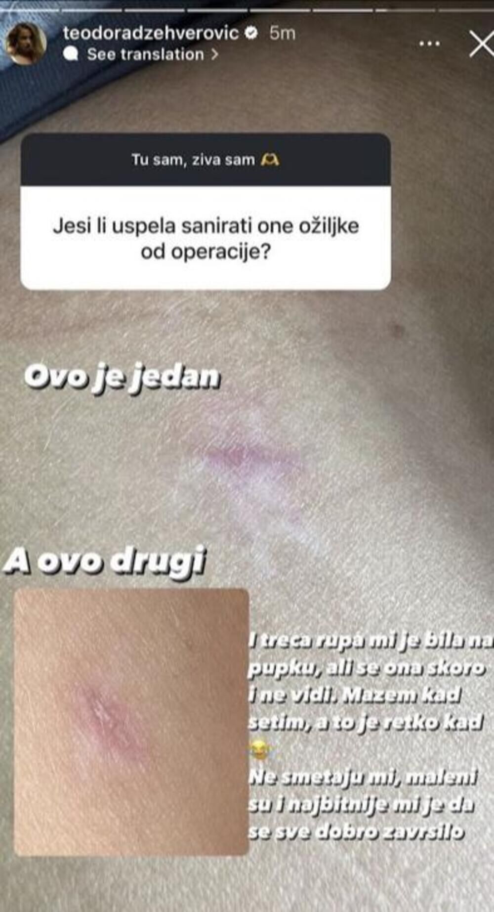 Teodora Džehverović posle operacije