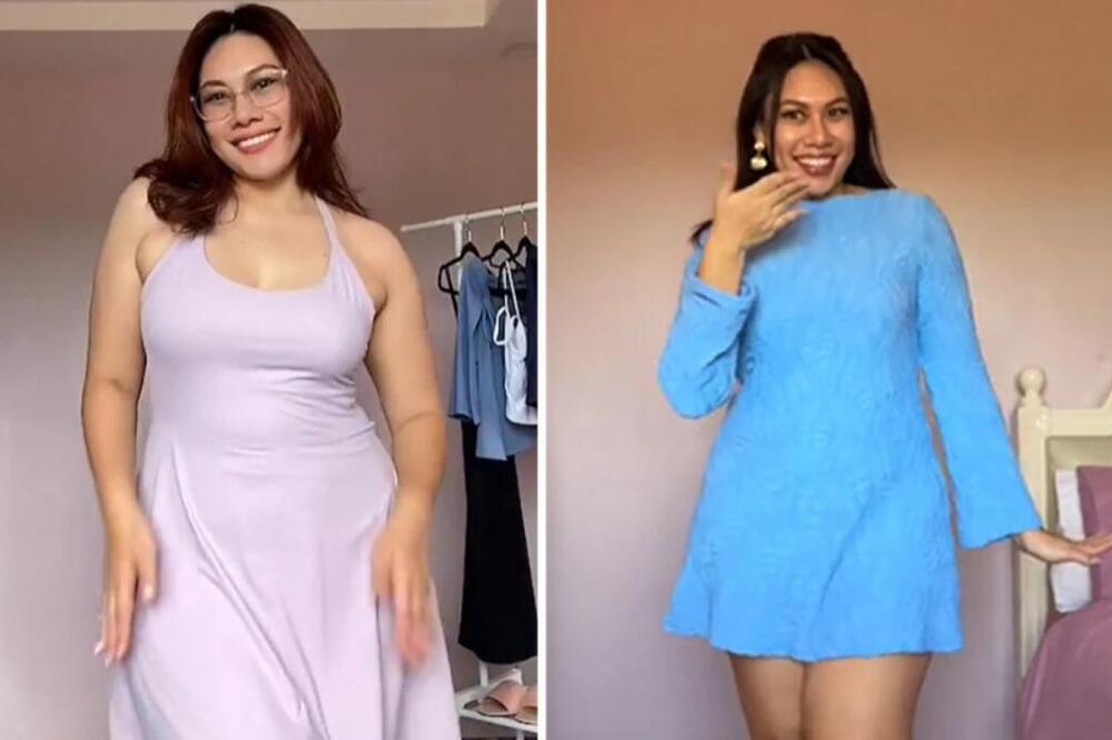 DEVOJKA OTKRILA ZBOG ČEGA JE RUBU SRAMA I POKAZALA SVOJE TELO: Ne može da nosi BIKINI i haljine zbog MASNIH NASLAGA