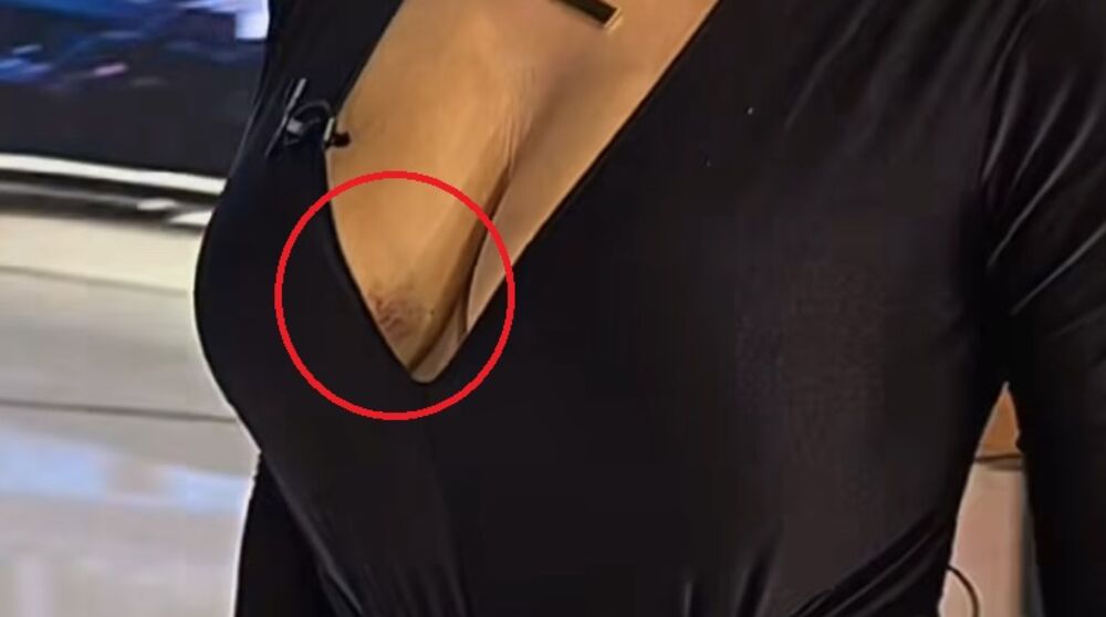 Da li se voditeljka udarila negde ili je ovo čuvena 'šljiva' ostaje nam da vidimo