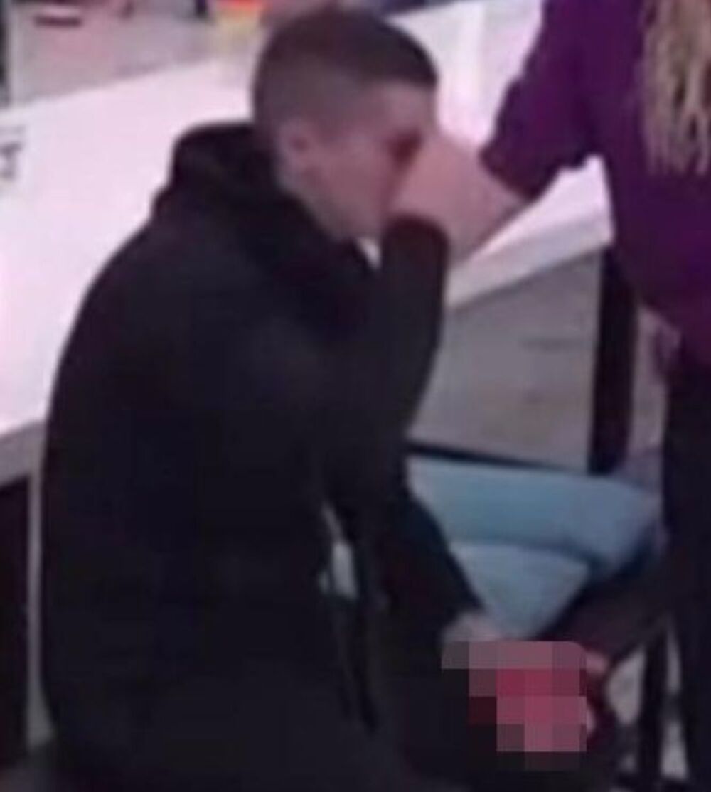 Nemanja Gačić polomio nos Bojani Pavlović