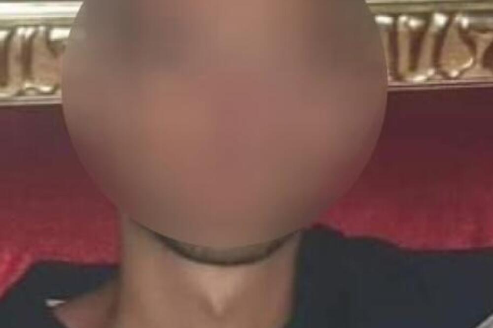 OVO JE POLICAJAC KOG JE MALOLETNIK IZBO U NOVOM PAZARU: Zadobio povrede obe noge i TESTISA, HITNO OPERISAN (FOTO)