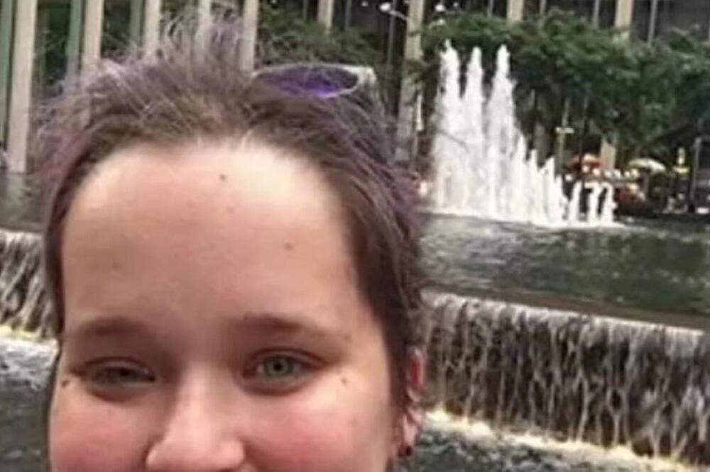 NA OVOM SELFIJU JE PRIMETILA PRVI ZNAK AGRESIVANOG RAKA NA MOZGU: Sledila se kad ga je VIDELA, rezultati bili HOROR