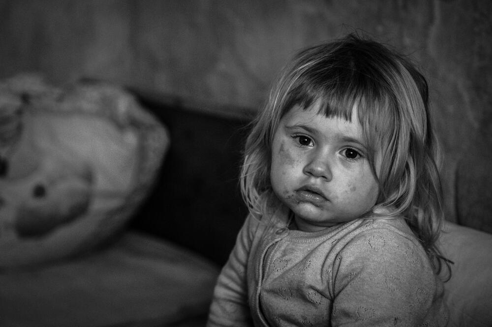 SUZNE OČI DUNJICE (2) POGAĐAJU PRAVO U SRCE: Sa braćom i sestrama odrasta u kući punoj pukotina,mašta samo o jednom