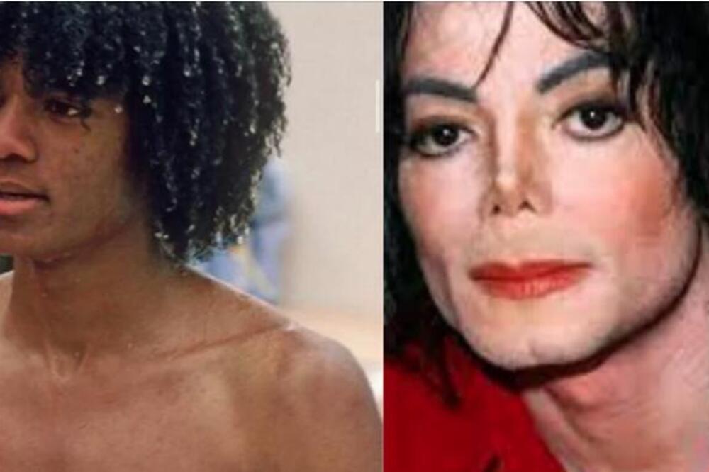 ŽENE I DALJE PLAČU NAD SLIKOM MAJKLA DŽEKSONA PRE OPERACIJA: Neće vam biti jasno ŠTO je dirao bilo ŠTA na sebi