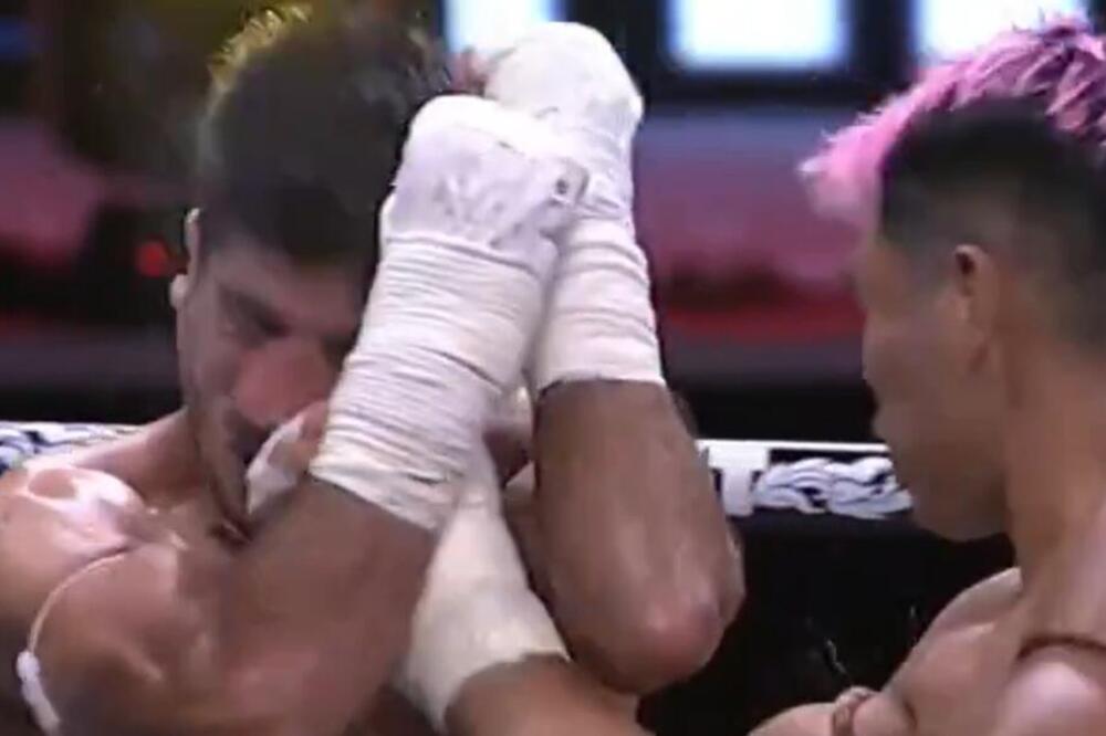 DA LI STE SPREMNI DA VIDITE JEDNU OD STRAŠNIJIH POVREDA U SVETU SPORTA: Snimak LEDI KRV u žilama! (VIDEO)