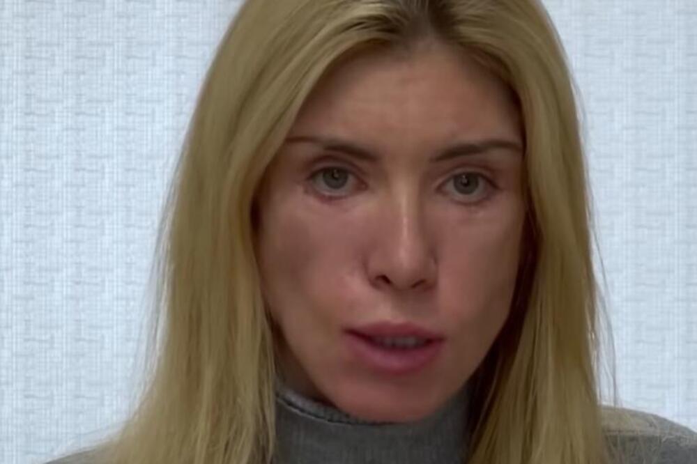 NAJLEPŠA ŽENA RUSIJE OTIŠLA NA OPERACIJU LICA PA ZAUVEK ZAŽALILA: Tužila lekare jer su je doslovno UNAKAZILI