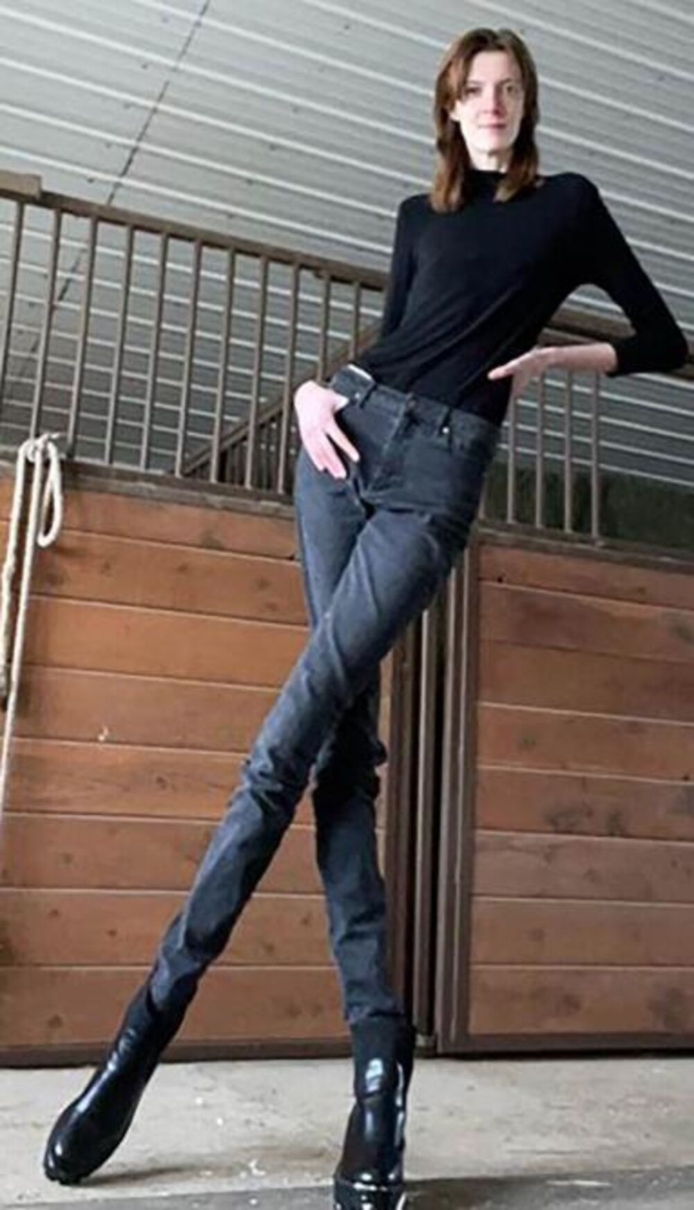 Žena sa najdužim nogama