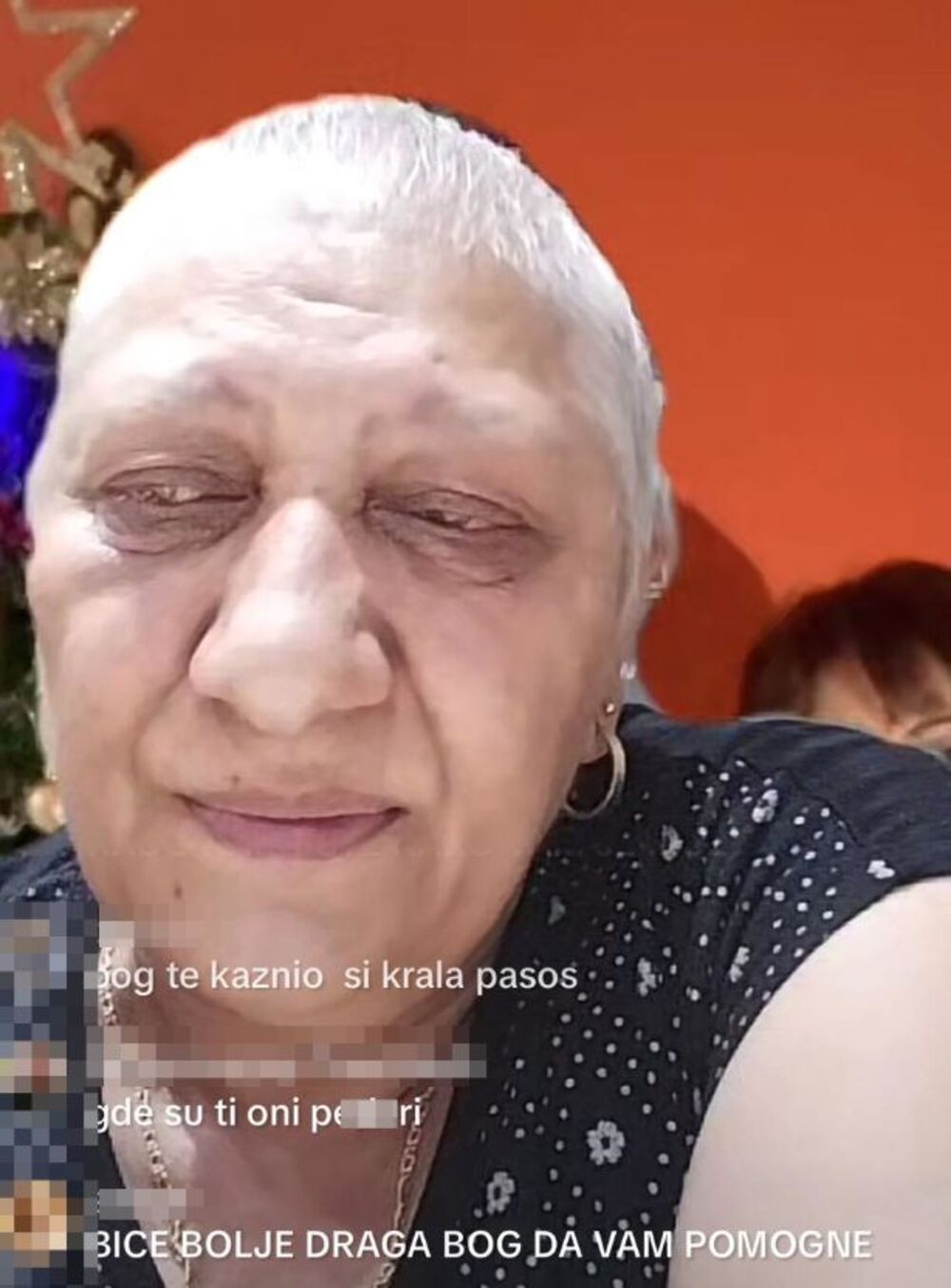 Rada Vasić boluje od teške bolesti