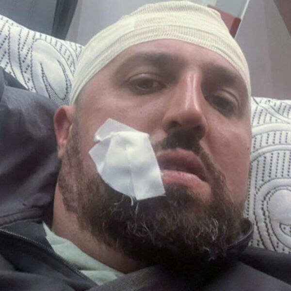 SRBIN PRETUČEN NA KOSOVU: Kosovski specijalci mu pretili pištoljem, ima povrede po glavi i telu