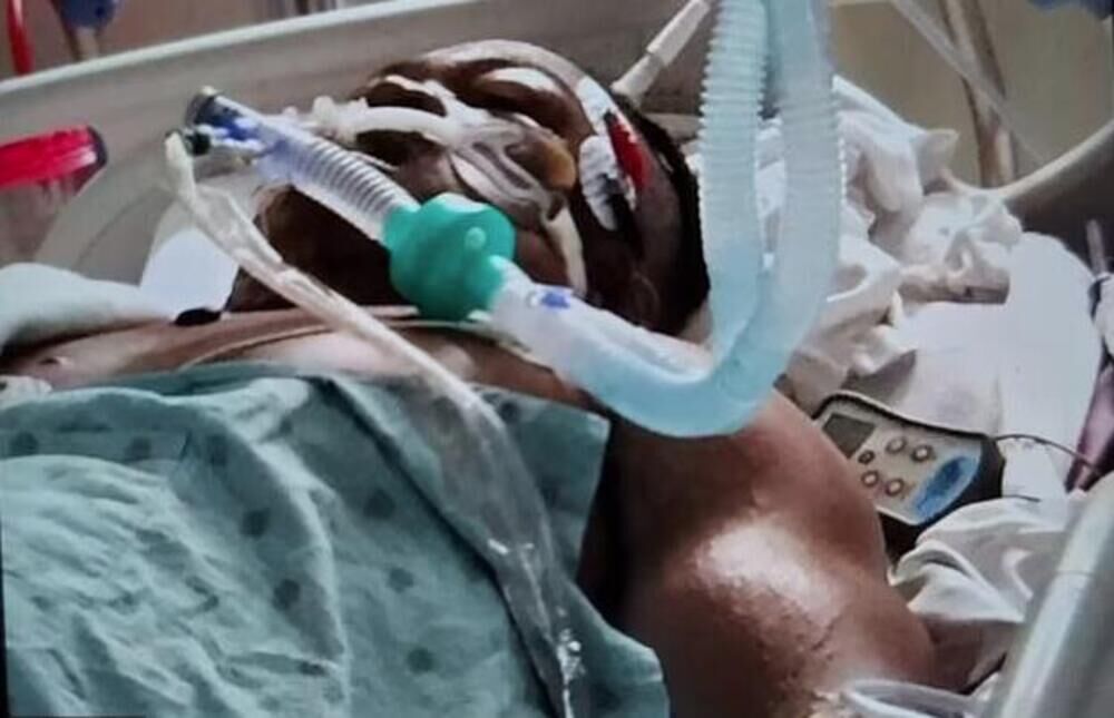 Bodibilder u bolnici