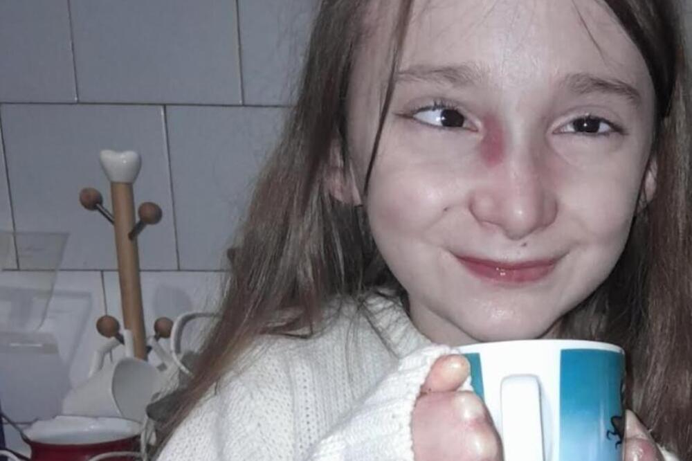 ANĐELA IZ ŠIDA JE DETE LEPTIR, NJENO TUŠIRANJE NEKAD TRAJE I PO 6 SATI: Poziva dobre ljude da joj pomognu