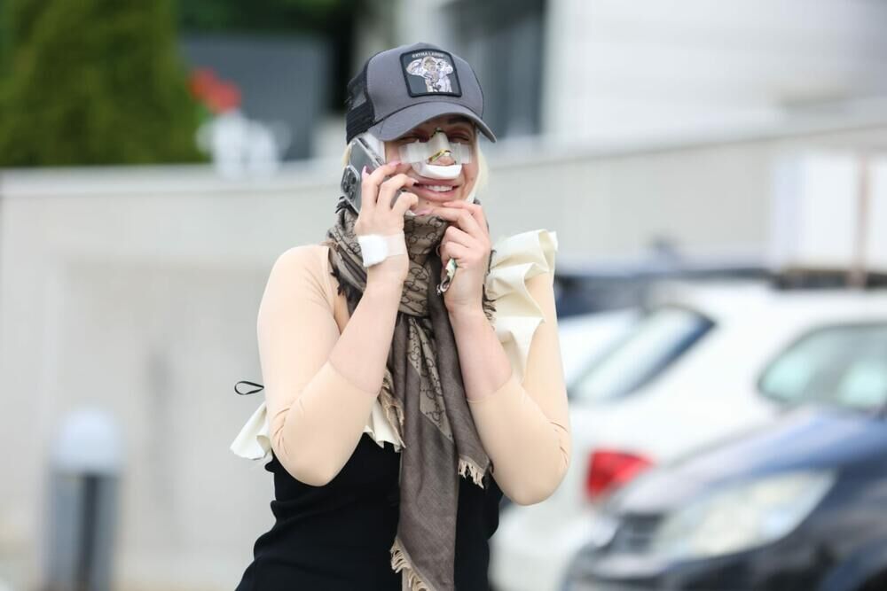 Radila zube, usta, nos, grudi...