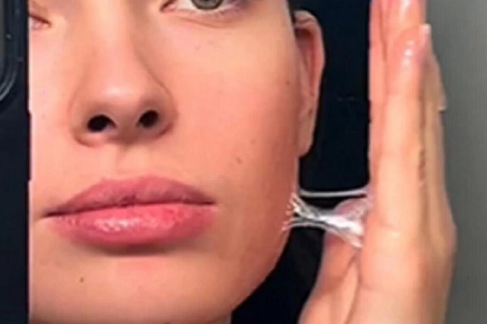 RECEPT ZA PRIRODNI BOTOKS KOJI JE HIT NA MREŽAMA: Seme OVE ŽITARICE čini čuda protiv bora, SRPKINJE IZVRIŠTALE