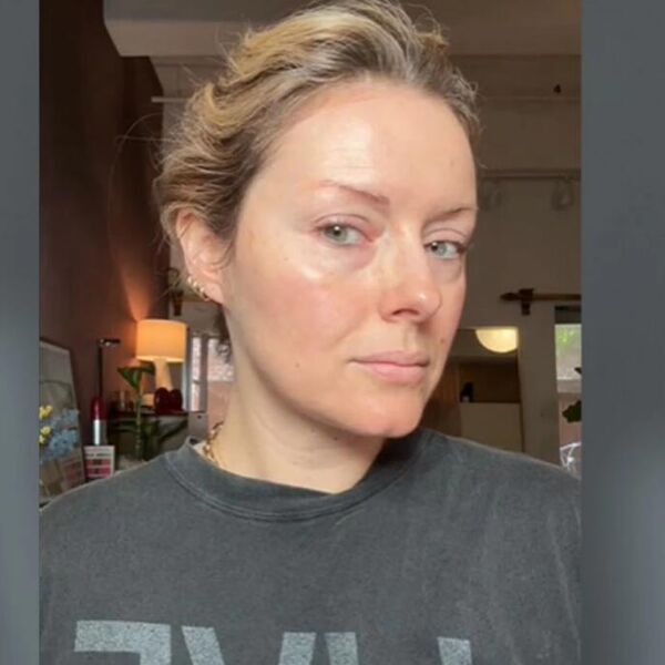 ŽENE SE KUNU U OVAJ PRIRODNI BOTOKS: Nema iglica i bola, evo kako da se OTARASIE BORA na NAJLAKŠI NAČIN (VIDEO)