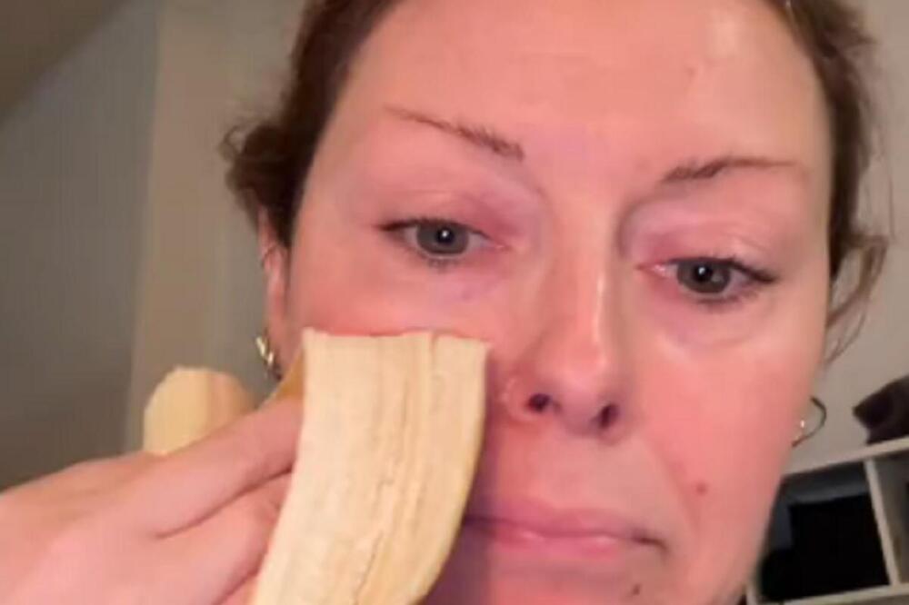 DA LI JE ZVANIČNO ODZVONILO BOTOKSU? Žena uzela KORU OD BANANE pa trlja po licu, trik koji se MASOVNO ŠIRI MREŽAMA