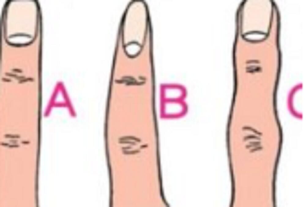 Prsti A, B i C