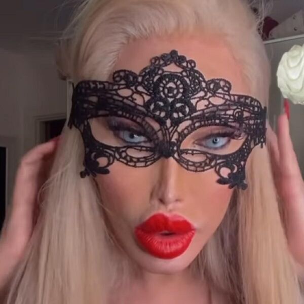 OVAKO SADA IZGLEDA ŽENA SA PREKO 100 OPERACIJA: Jedva diše i govori, jedini CILJ joj je da ŠOKIRA ŠTO VIŠE LJUDI