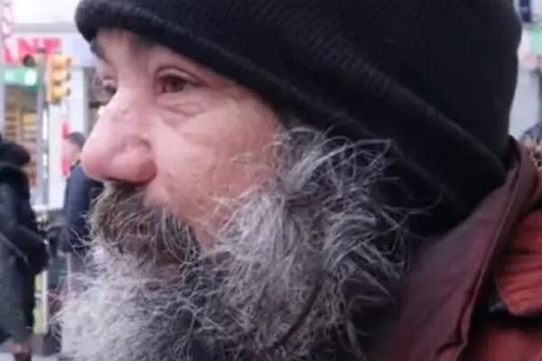 ODVELI SU BESKUĆNIKA NA TRANSFORMACIJU ŽIVOTA: Posle nje, NIKO nije mogao da ga prepozna, au ljudi, šta je ovo