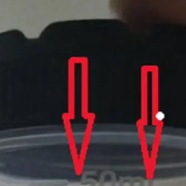 DOKTOR MU JE REKAO DA DONESE UZORAK STOLICE, A KAD JE VIDEO ŠTA MU JE DONEO...Hteo je da ga prebije na mrtvo ime