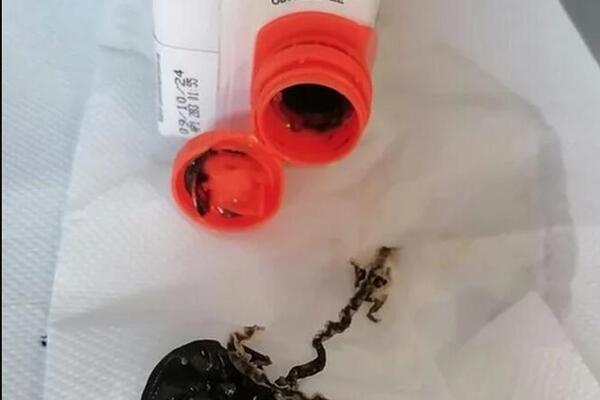 SRPKINJA U SOKIĆU NAŠLA ČUDOVIŠTE, KAD JE OTVORILA PREVRNUO JOJ SE ŽELUDAC: "Jel zna neko šta je IZAŠLO IZ NJEGA?"