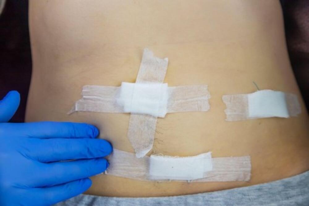 OSETILA JE TOLIKO JAKE BOLOVE PA POMISLILA DA JOJ JE PUKLO SLEPO CREVO: Kad su se oglasili DOKTORI, pala u NESVEST