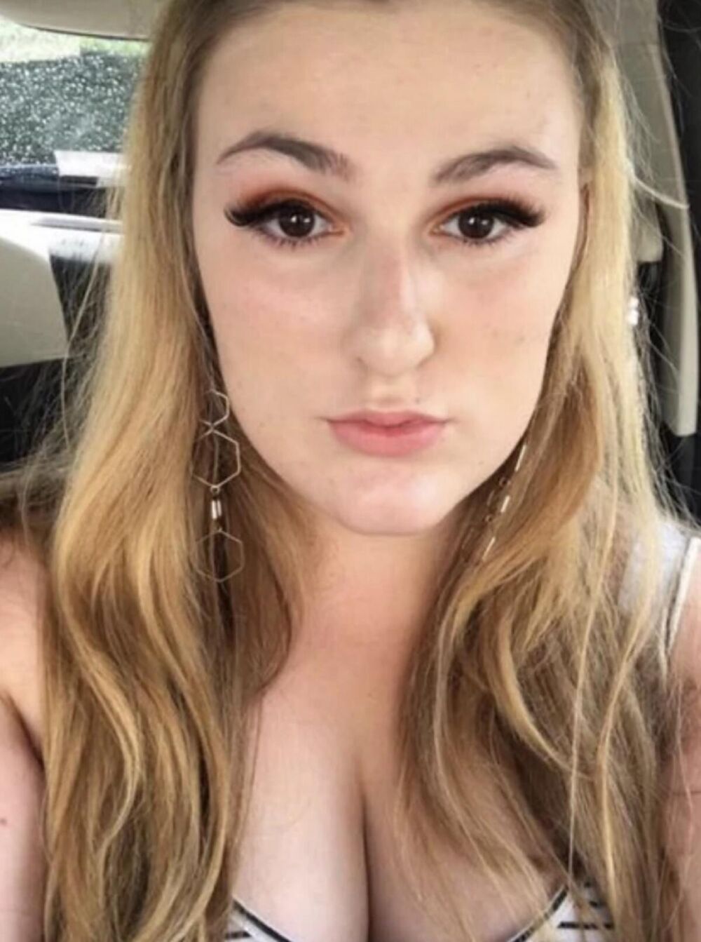 Tada su doktorili primetili su da joj je membrana u uhu ispupčena i da bi trebalo da radi dalja testiranja.