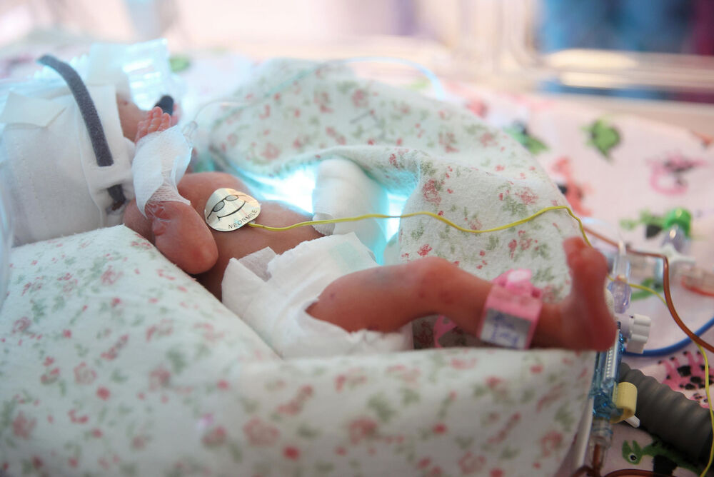 Inkubator, Bebe, beba u inkubatoru, Beba, Porodilište