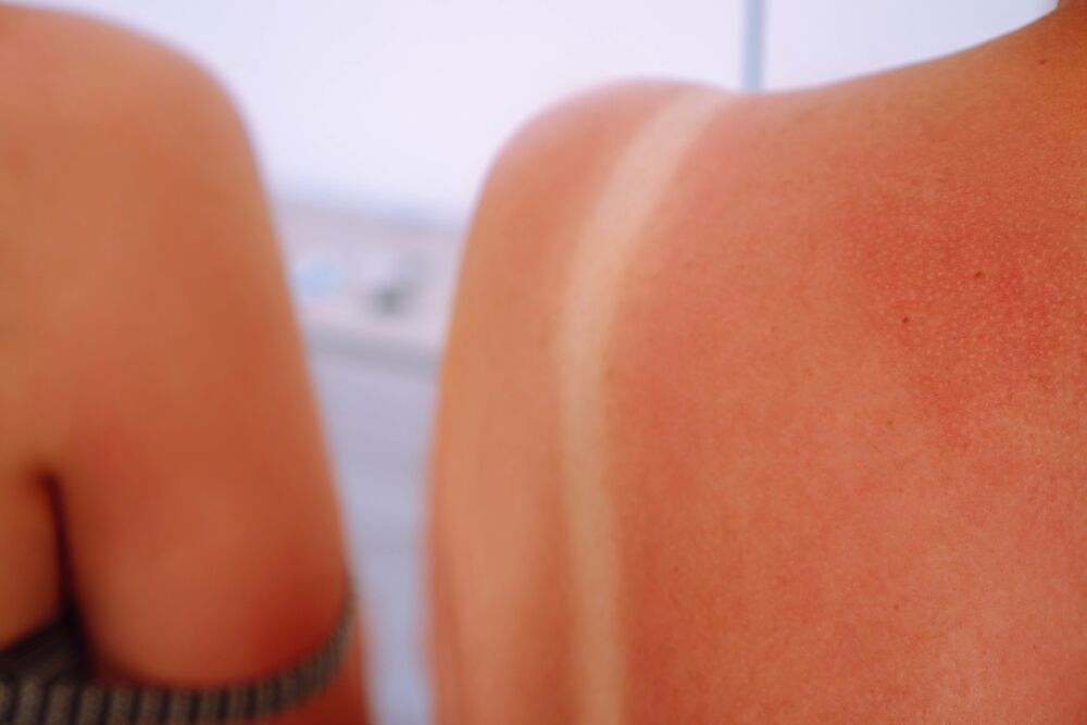 SPF faktor ne pokazuje koliko dugo možete da budete na suncu