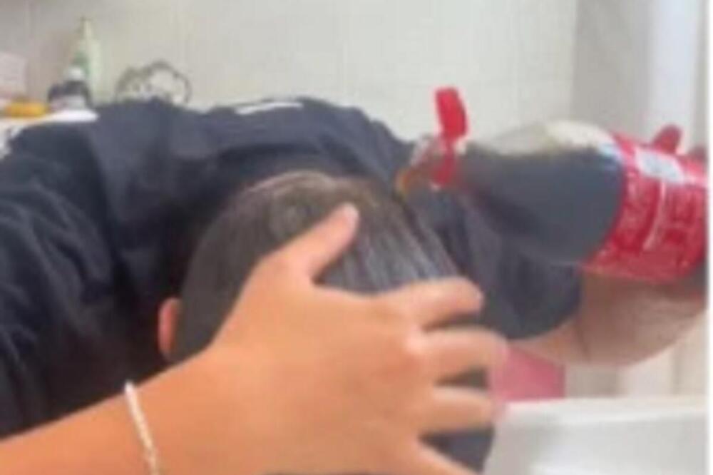 UZELA KOKA-KOLU I POSULA SEBI PO GLAVI, TVRDI DA ĆE JOJ KOSA BITI BOLJA: Sve je snimila, USLEDIO ŠOK, da se naježiš
