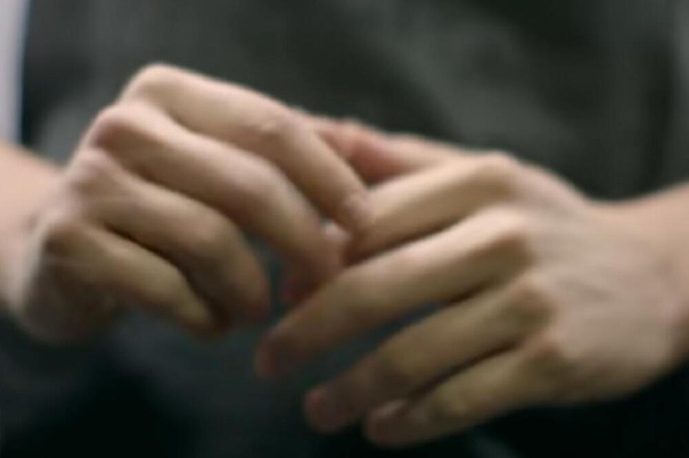 DA LI PRETERANO PUCKETANJE PRSTIJU RAZVIJA ARTRITIS? Ova navika je za mnoge "BEZAZLENA", a ne znaju da...