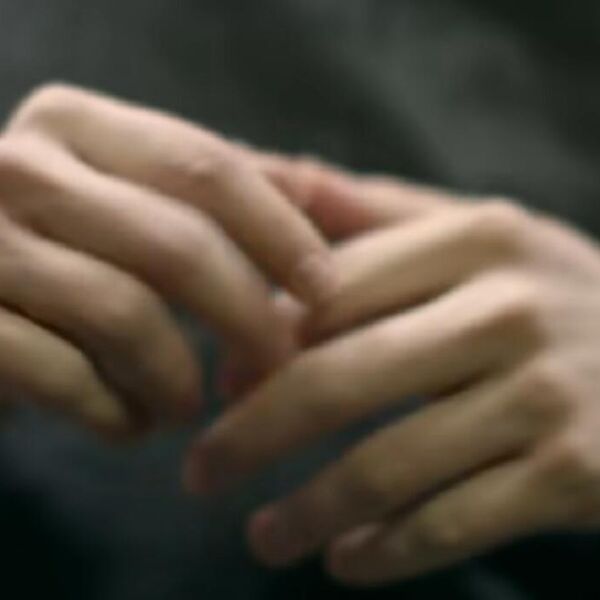 Da li krckanje prstiju izaziva artritis? Lekar testirao na sebi i evo šta je otkrio nakon 60 godina!