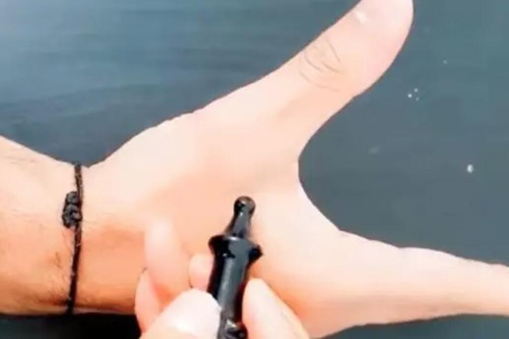 Ako pritisnete 1 tačku na ruci, bolovi će odmah prestati: Naši stari preci su znali za ovaj trik, probajte obavezno