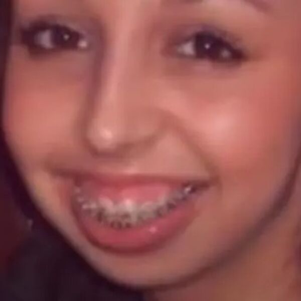 Ismevali su je ceo život zbog izgleda, a onda je prošla ogromnu transformaciju: Ljudima padaju vilice kada je vide