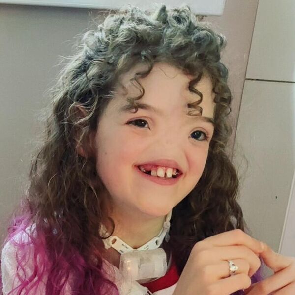 Ova devojčica je jedna od 100 ljudi rođenih bez nosa: Od rođenja diše na usta, zbog izgleda je najgore prozivali