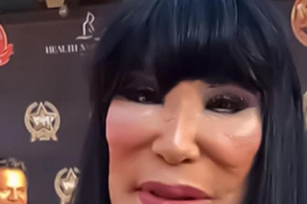 Ova žena je bila lepotica kakvu svet nije video, a sad je kao lik iz horora: Izdeformisana od plastičnih operacija