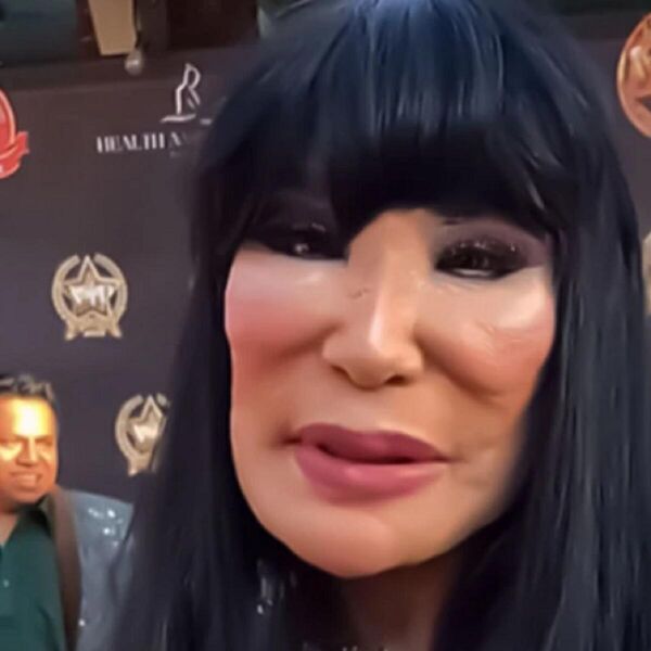 Ova žena je bila lepotica kakvu svet nije video, a sad je kao lik iz horora: Izdeformisana od plastičnih operacija