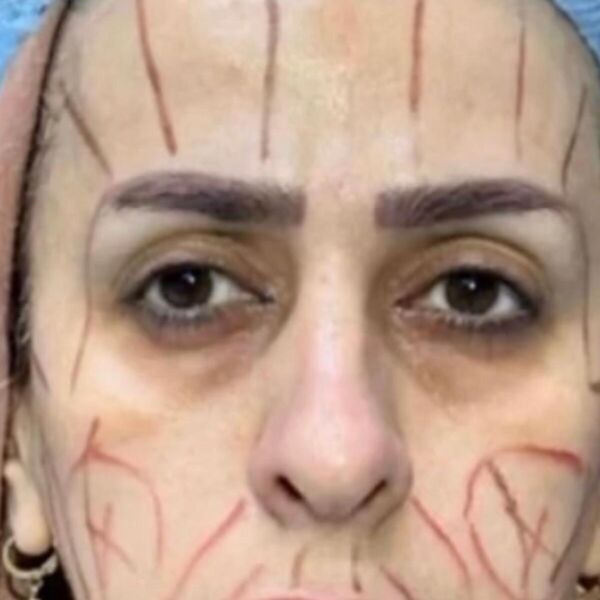 Kad je doktor uhvatio u svoje ruke, prestala da liči na sebe: Sad mora da vadi nova dokumenta - transformacija veka