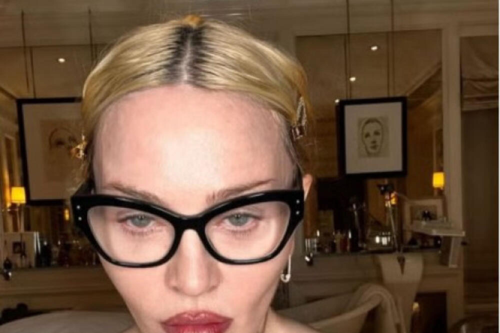 "Potpuno se izobličila, ne liči na sebe": Pevačica objavila sliku bez šminke, pa usledio linč, šta je s glavom?